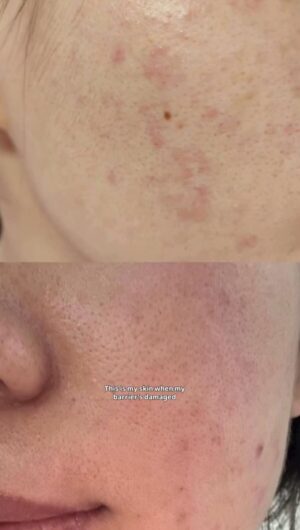 Kerina Wang - My barrier repairer and glass skin SECRET