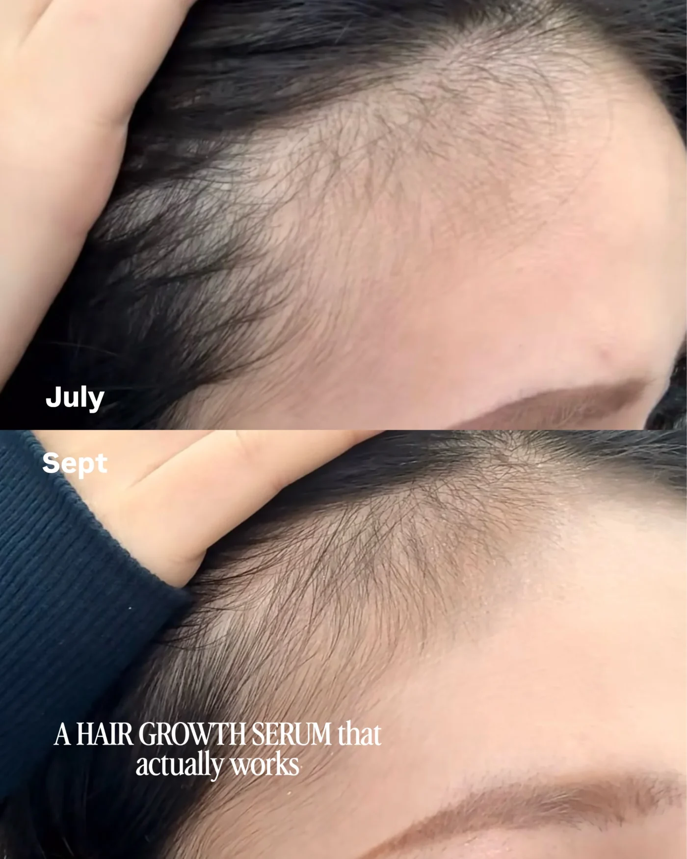Hair growth serum July vs Sept