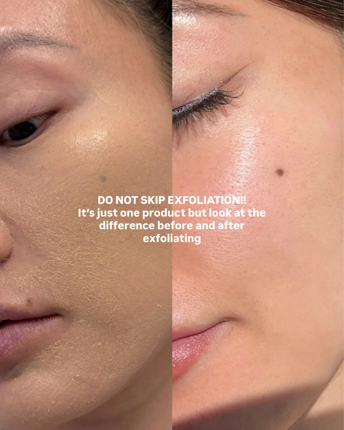 Before and after exfoliating